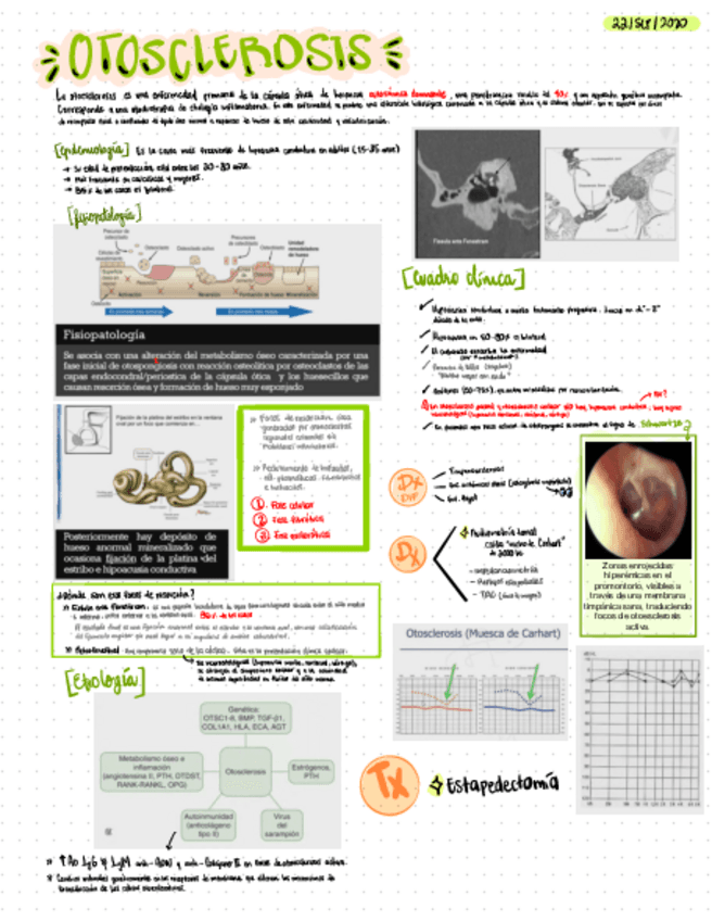Miniatura del documento OTOESCLEROSIS-Y-ACUFENO.pdf