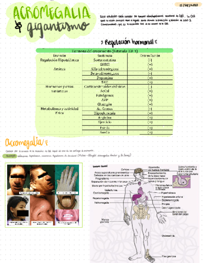 Miniatura del documento Acromegalia-y-gigantismo.pdf