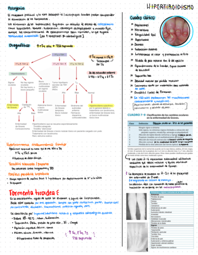 Miniatura del documento hipertiroidismo.pdf