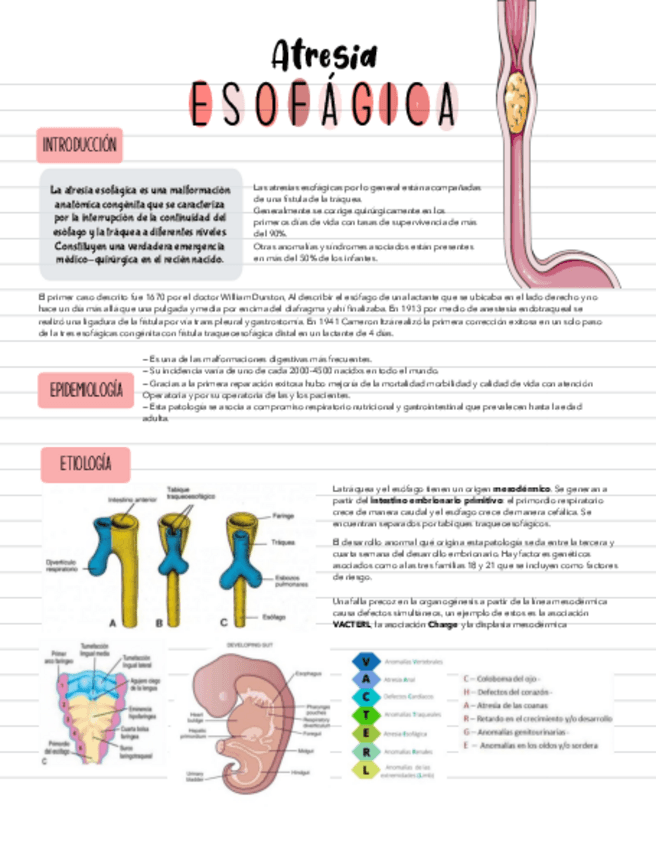 Miniatura del documento ATRESIA-ESOFAGICA.pdf