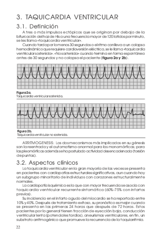 Miniatura del documento ARRITMIA-VENTRICULAR.pdf