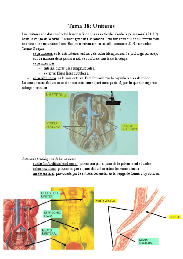 Miniatura del documento Tema-38-Ureteres.pdf