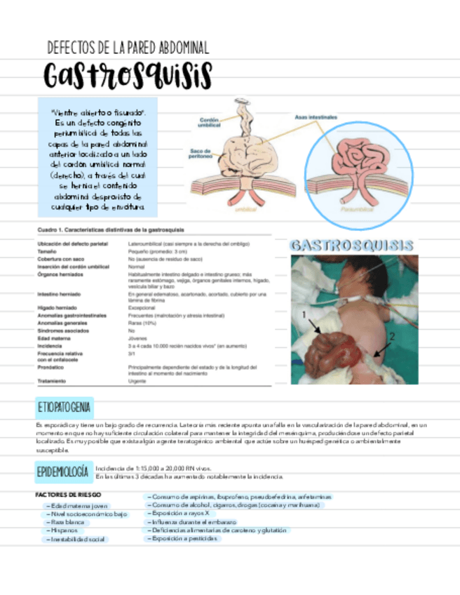 Miniatura del documento gastrosquisis.pdf