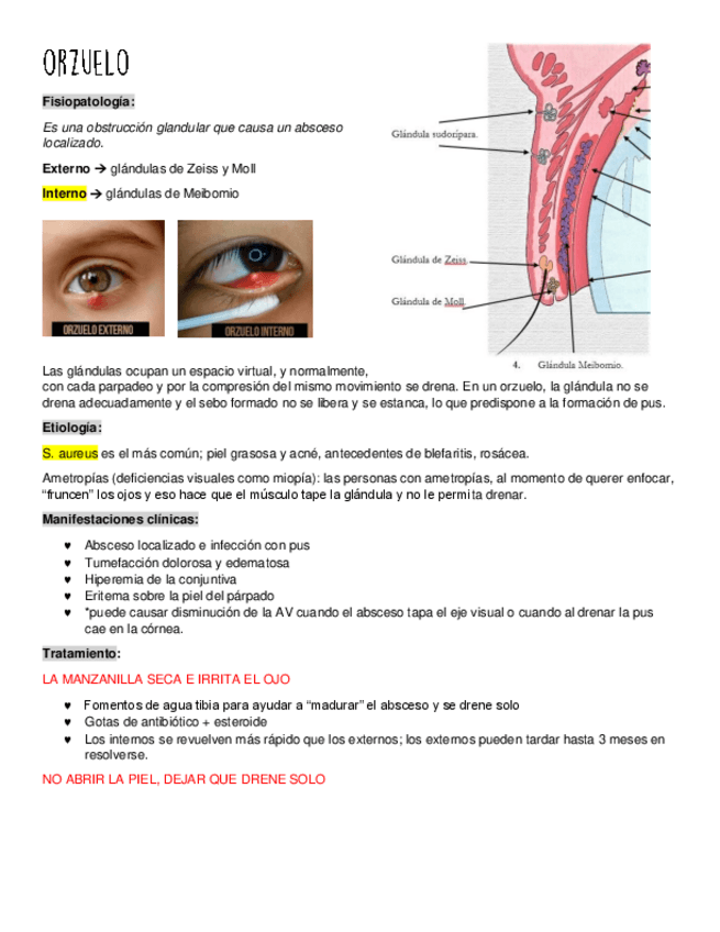 Miniatura del documento orzuelo-y-chalazion.pdf