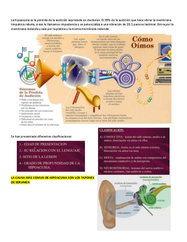 Miniatura del documento HIPOACUSIA.pdf