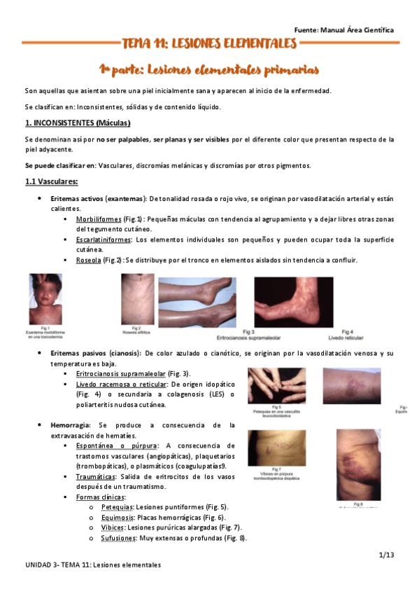 Miniatura del documento TEMA-11.pdf