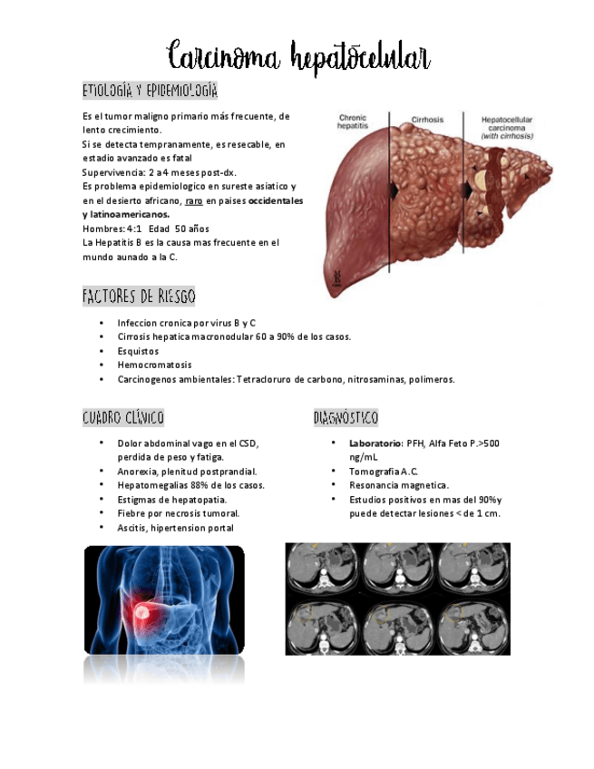 Miniatura del documento CARCINOMAHEPATOCEL.pdf