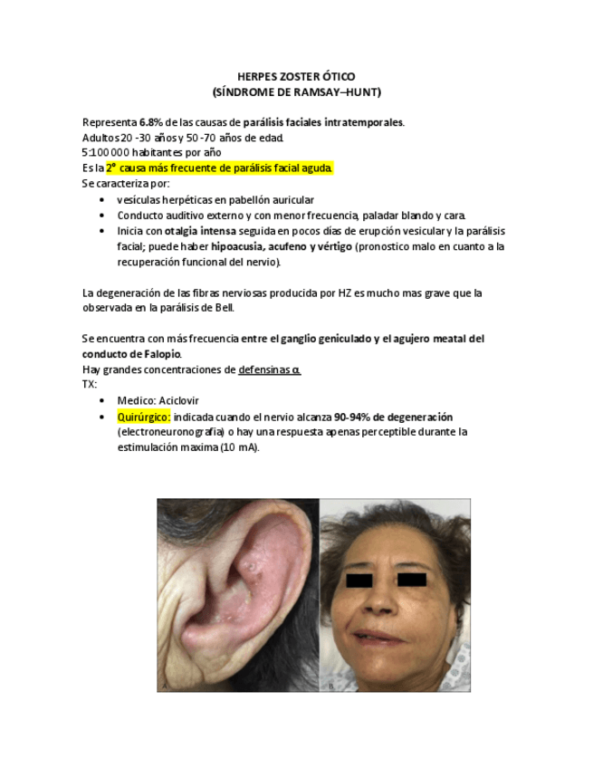 Miniatura del documento Sindrome-de-Ramsay-Hunt.pdf