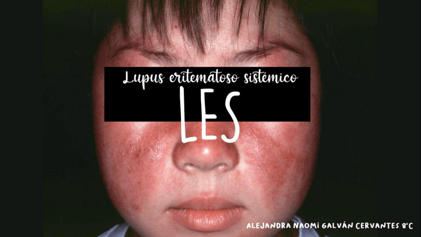 Miniatura del documento LES-nayomi.pdf