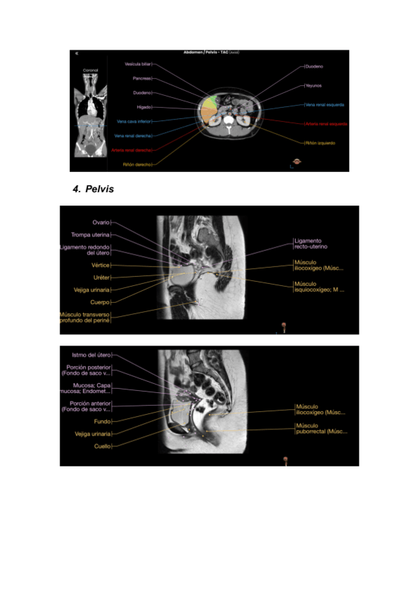 Miniatura del documento IMAGENES-DE-ANATOMIA-RADIOLOGICA-2.pdf