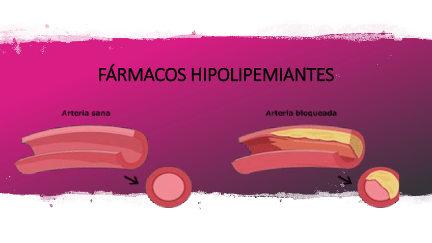 Miniatura del documento FARMACOS-HIPOLIPEMIANTES.pdf