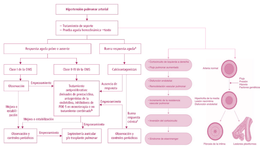 Miniatura del documento HIPERTENSION-PULMONAR-ARTERIAL.pdf
