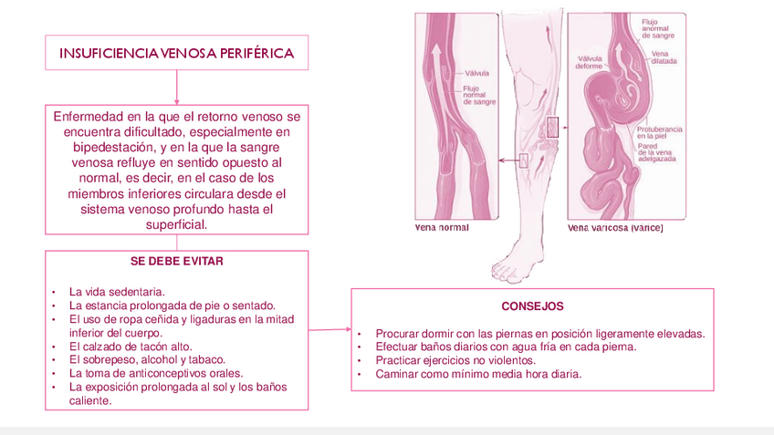 Miniatura del documento INSUFICIENCIA-VENOSA-PERIFERICA.pdf