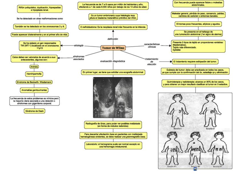 Miniatura del documento TUMOR-DE-WILMS.pdf