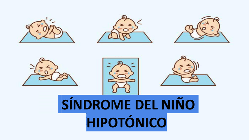Miniatura del documento SINDROME-DEL-NINO-HIPOTONICO.pdf