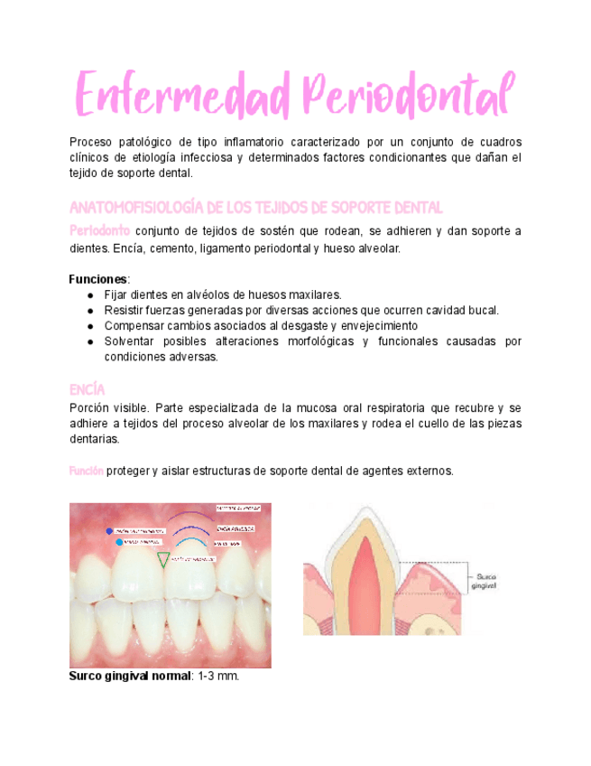 Miniatura del documento Enfermedad-periodontal.pdf