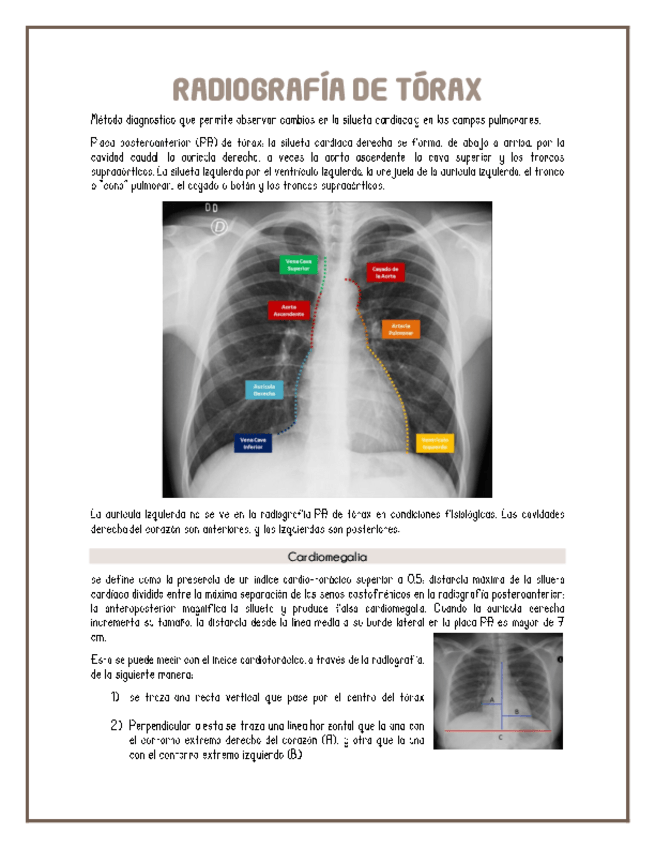Miniatura del documento radiografia-de-torax.pdf