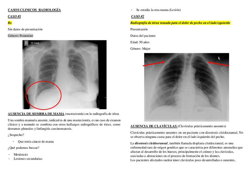Miniatura del documento CASOS-CLINICOS-DE-RADIOLOGIA.pdf
