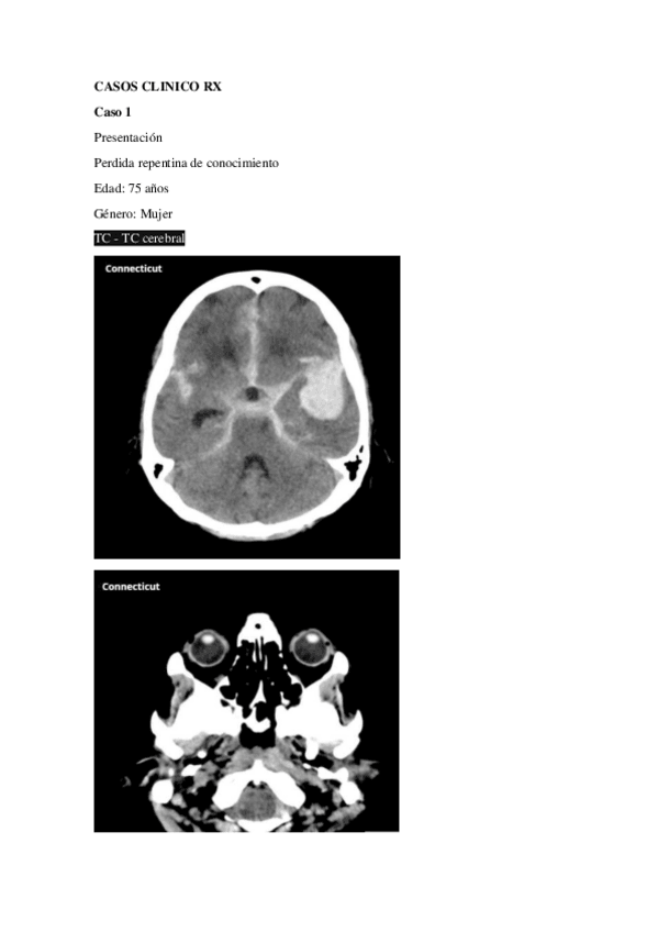 Miniatura del documento CASOS-CLINICOS-RX-CRANEO.pdf