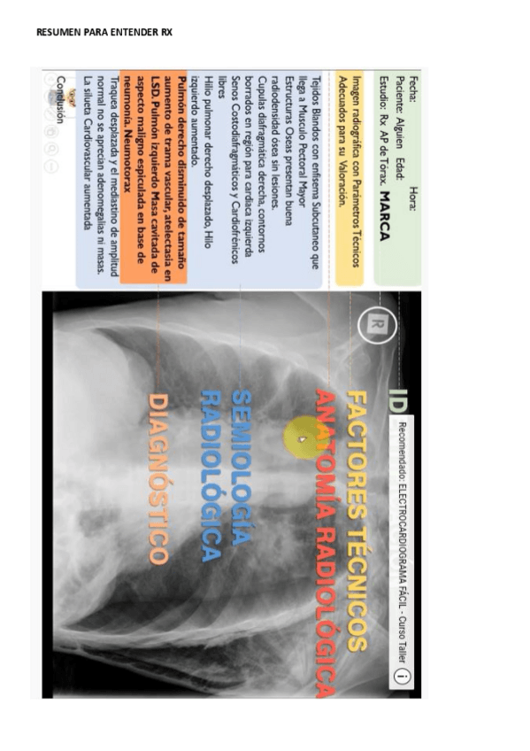 Miniatura del documento RESUMEN-PARA-ENTENDER-RX.pdf