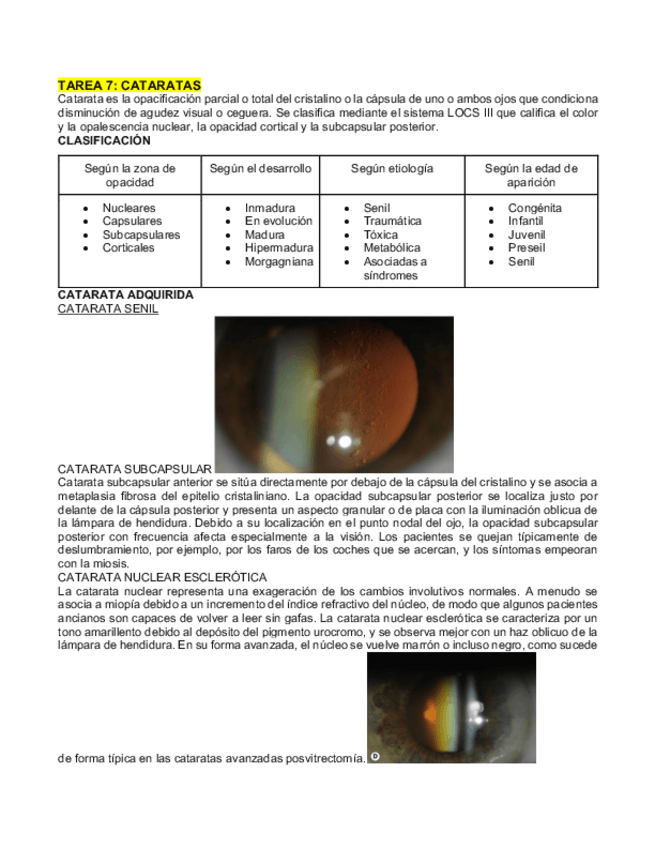 Miniatura del documento CATARATAS.pdf