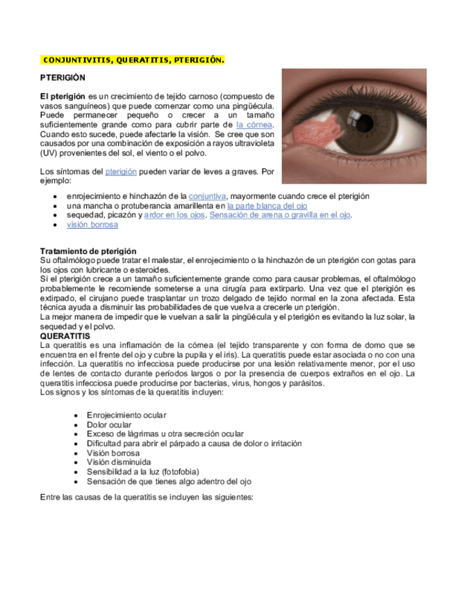 Miniatura del documento CONJUNTIVITIS-QUERATITIS-PTERIGION.pdf