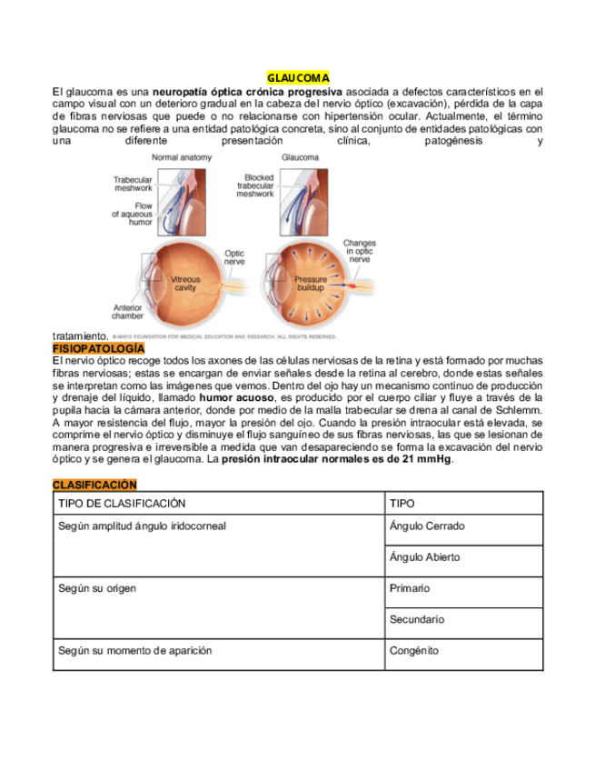 Miniatura del documento GLAUCOMA.pdf