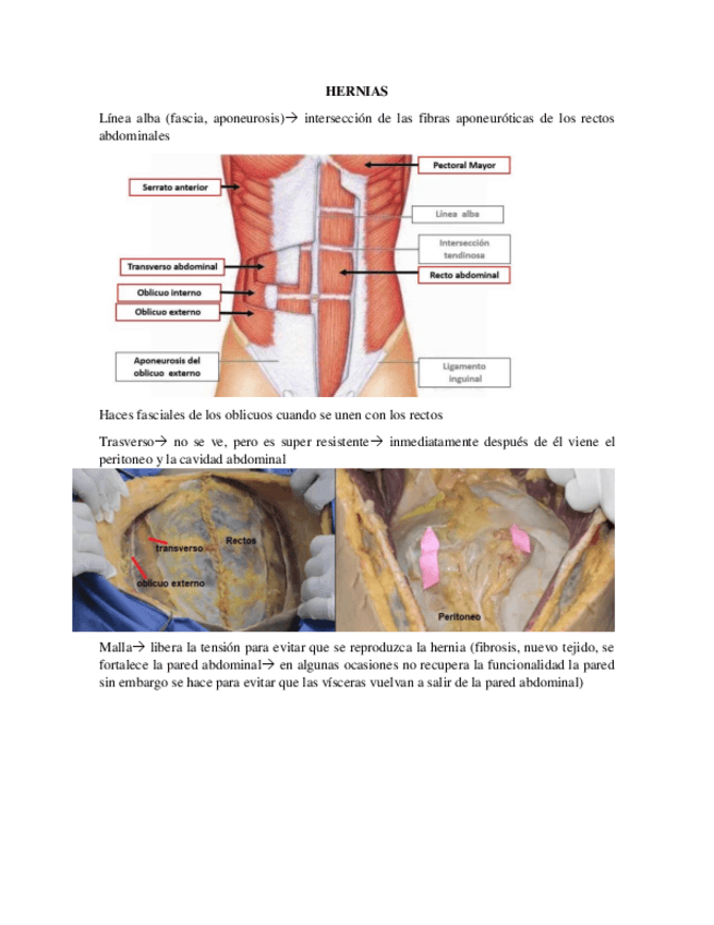 Miniatura del documento HERNIAS-.pdf