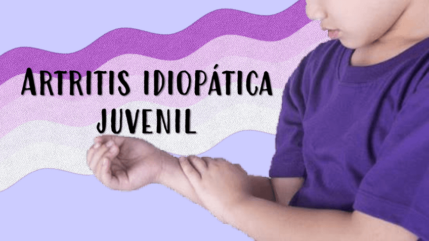 Miniatura del documento Artritis-reumatoide-juvenil.pdf