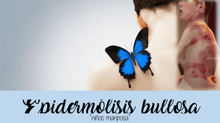 Miniatura del documento Epidermolisis-bullosa.pdf