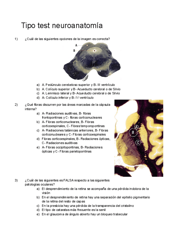 Miniatura del documento Tipo-Test-Neuroanatomia.pdf