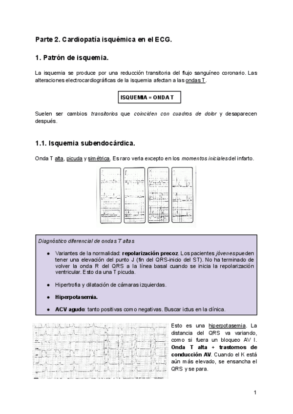 Miniatura del documento ECG-isquemia.pdf