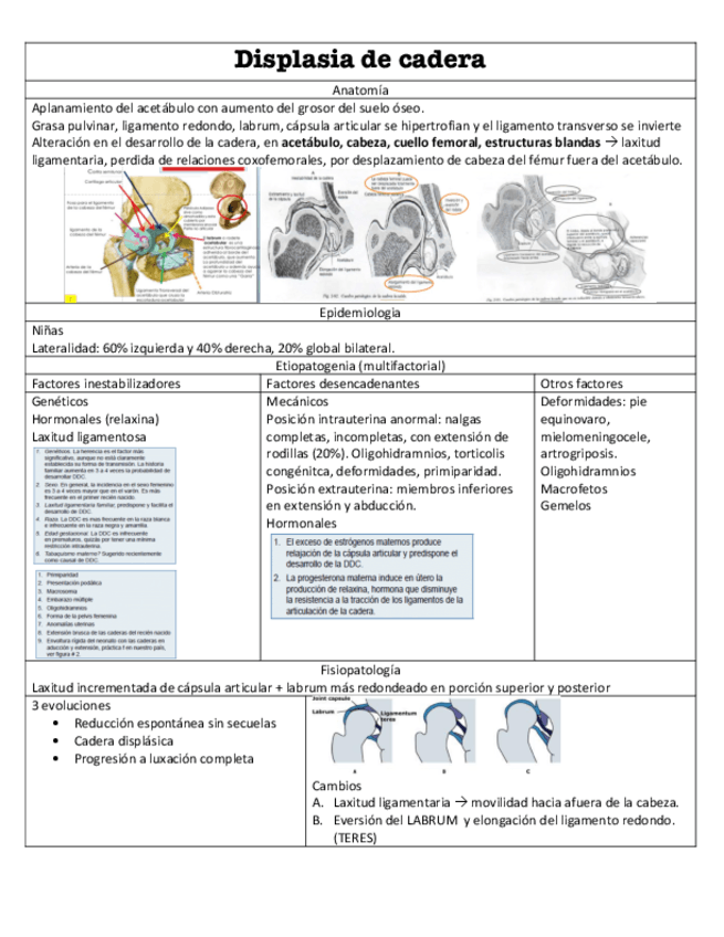Miniatura del documento Displasia-de-cadera.pdf