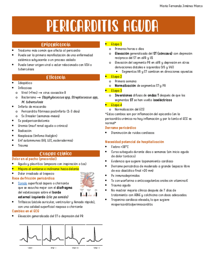 Miniatura del documento Pericarditis-Aguda.pdf
