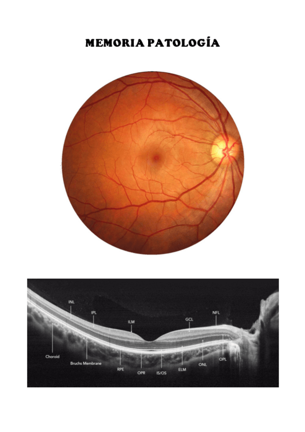 Miniatura del documento MEMORIA-PATOLOGIA.pdf