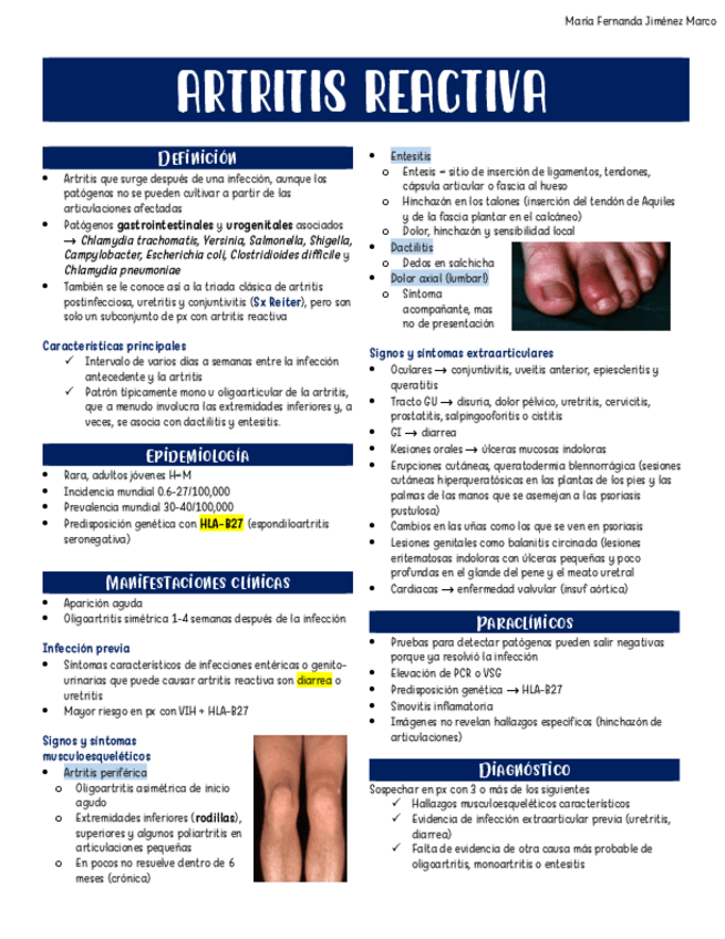 Miniatura del documento Artritis-reactiva.pdf