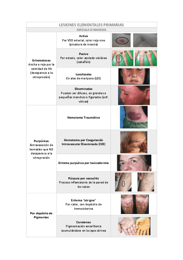 Miniatura del documento Lesiones-Elementales-Primarias-Derma.pdf