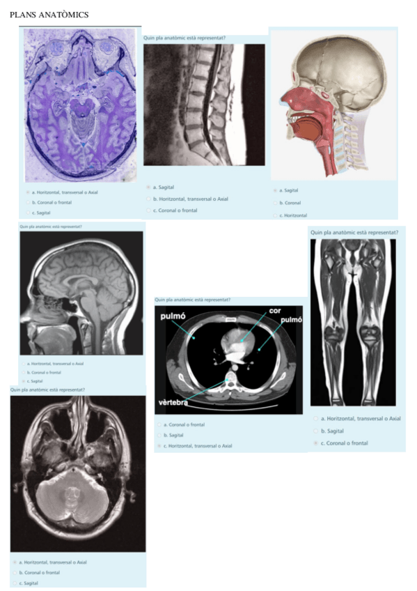 Miniatura del documento EXAMEN-ANATOMIA-avaluacio-continua.pdf