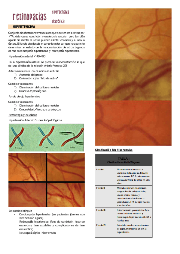 Miniatura del documento Retinopatia-hipertensiva-y-diabetica.pdf