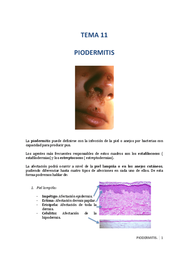 Miniatura del documento 11. Piodermitis 29-09-2014.pdf