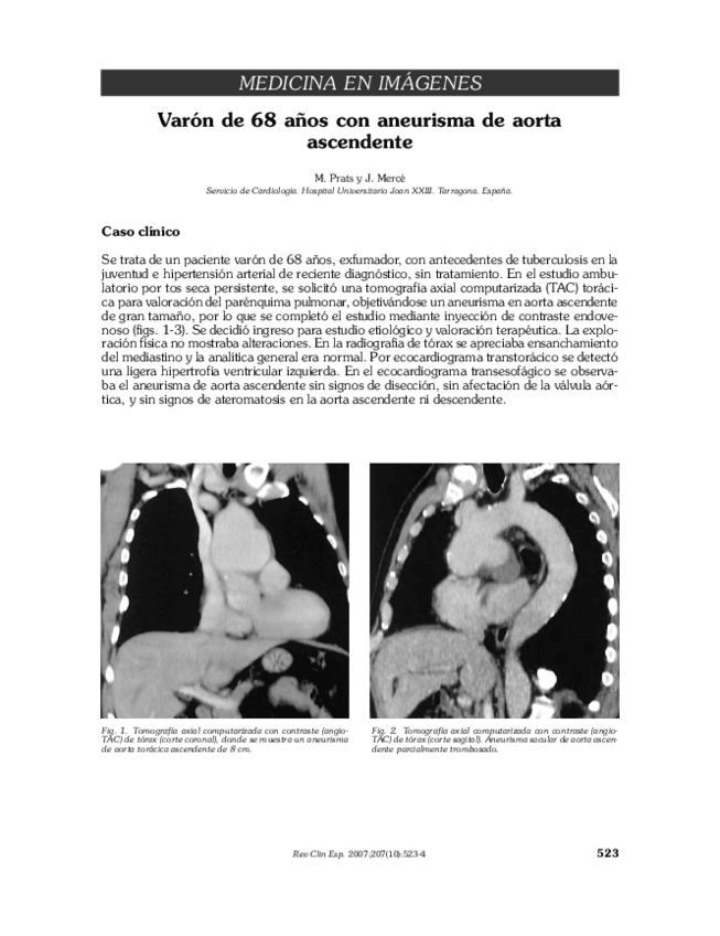 Miniatura del documento Mediastino-Caso-clinico.pdf