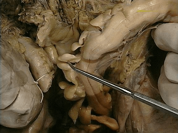 Miniatura del documento vestibulo nasal.jpg