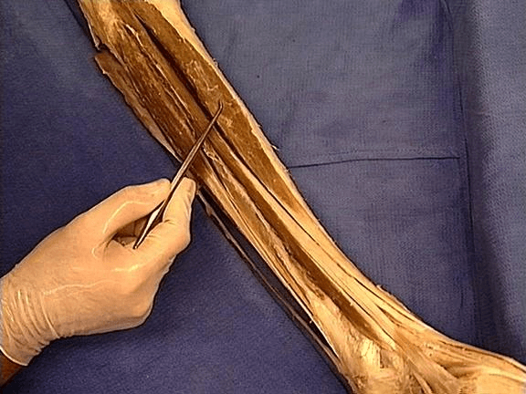 Miniatura del documento musculo extensor largo del dedo gordo.jpg