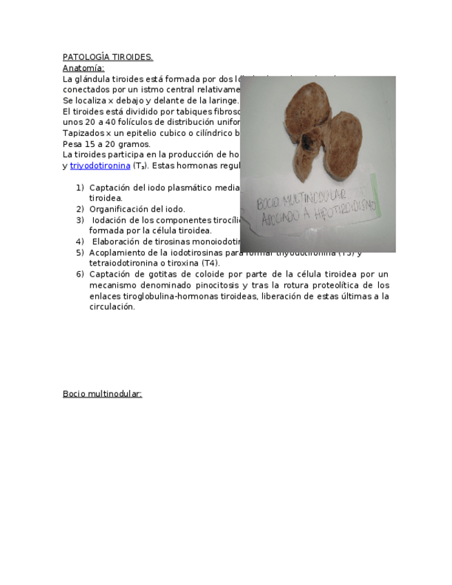 Miniatura del documento PATOLOGIA-TIROIDES.docx