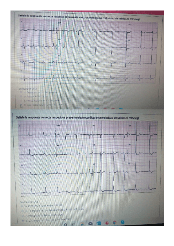 Miniatura del documento ACFrOgDUiCsz3pRjc1UvDJLHdByruwTHmFs9h0pBihRqWh-laPRYatkBTw0xlV0udwtL-hPfulTxKPXB84SuAgguytGY1FWp3jXBCBZxQKMDtB90MfYEJ0VNKSKbVvIYbxbBLhXhWpxEB1gc.pdf
