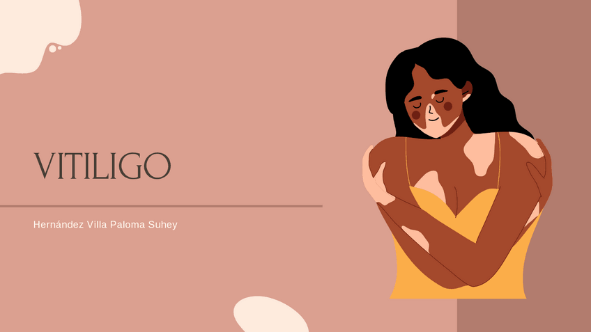 Miniatura del documento Vitiligo.pdf