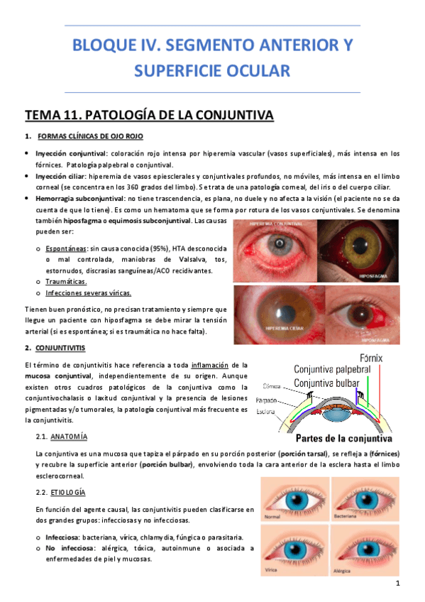 Miniatura del documento BLOQUE-IV-SEGMENTO-ANTERIOR-Y-SUPERFICIE-OCULAR.pdf