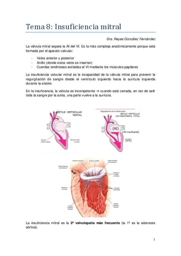 Miniatura del documento Tema 8. Insuficiencia mitral (Valvulopatía mitral).pdf