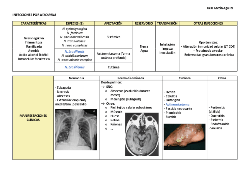 Miniatura del documento NOCARDIA.pdf
