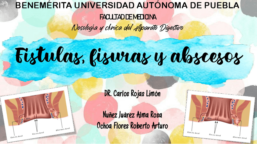 Miniatura del documento FISTULAS-FISURAS-Y-ABSCESOS.pdf